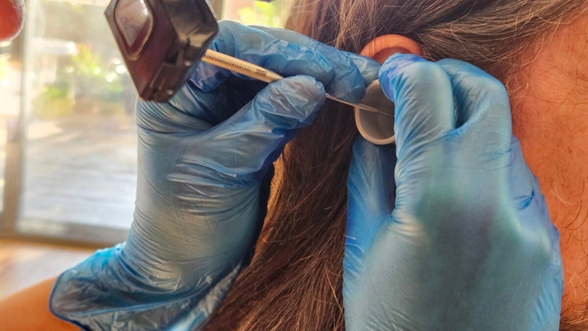  20240903 160028 syringing vs microsuction whats safest for your ears   the audiology place